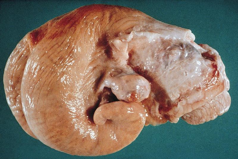 Gebärmutter (Uterus) Entdecken Sie die verschiedenen Funktionen, den Aufbau und die Entwicklung der Gebärmutter einer fruchtbaren Kuh.